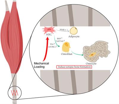 Heterotopic Ossification: Clinical Features, Basic Researches, and Mechanical Stimulations